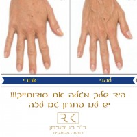 ד"ר רון קורמן אומנות הרפואה האסתטית