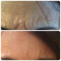 ד"ר רון קורמן אומנות הרפואה האסתטית