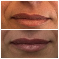 ד"ר רון קורמן אומנות הרפואה האסתטית