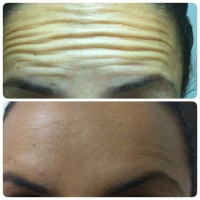 ד"ר רון קורמן אומנות הרפואה האסתטית