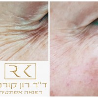 ד"ר רון קורמן אומנות הרפואה האסתטית