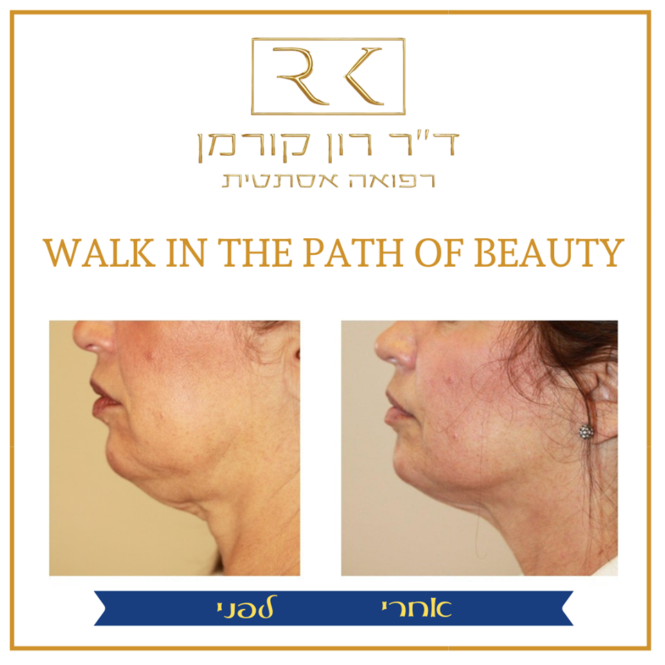 טיפול מוצלח ברפואה אסתטית