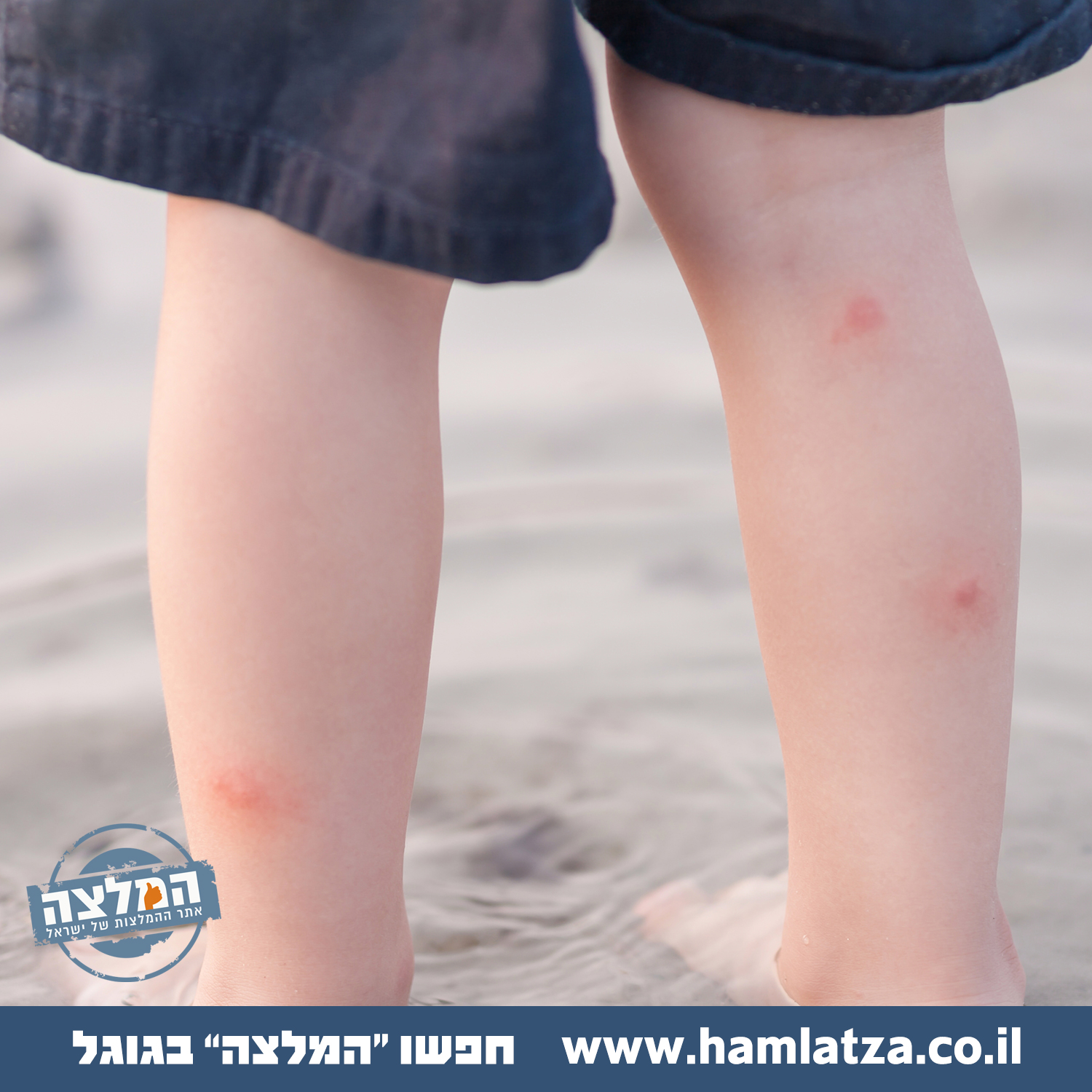 טיפים להרחקת יתושים בקיץ